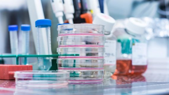 «Дочка» АФК «Система» разработала экспресс-тест на коронавирус