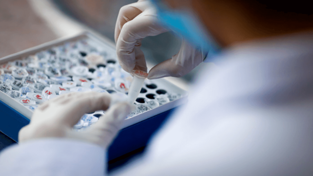 Искусственный интеллект обнаружил для людей эликсир молодости