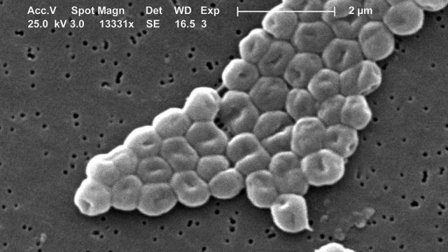 Возможно, НАСА нашло и случайно убило жизнь на Марсе 50 лет назад: как это произошло