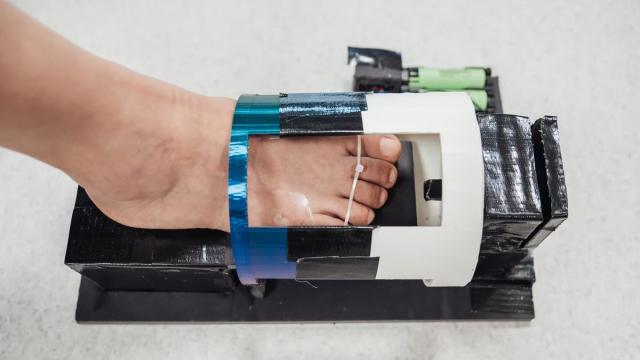 Магнитный гель ускоряет заживление ран втрое: как это работает