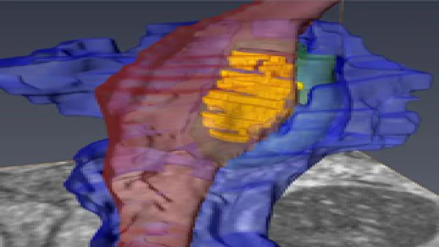 Прорыв в нейробиологии: запечатлены невидимые ранее детали синапса головного мозга