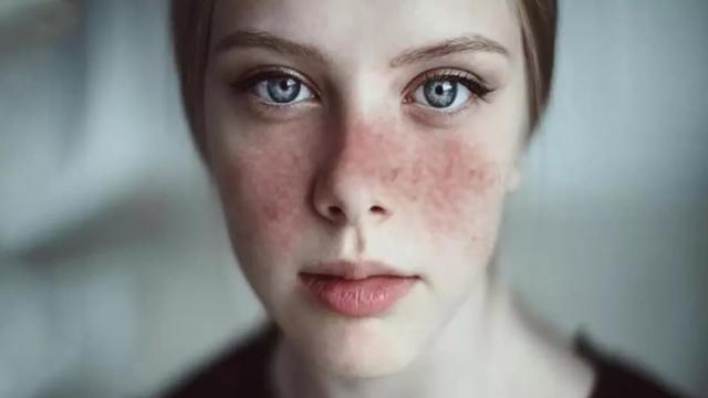 О каких болезнях могут предупреждать пятна на теле — об этом должны знать все