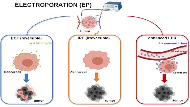 Что такое электрохимиотерапия и насколько она эффективна?
