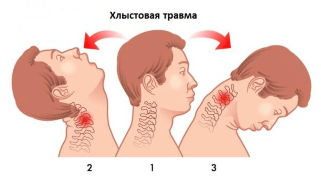 Что может случиться с вашим организмам от катания на экстремальных аттракционах