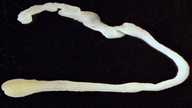 Врачи вытащили из мозга мужчины живого червя длиной 18 см: как он туда попал