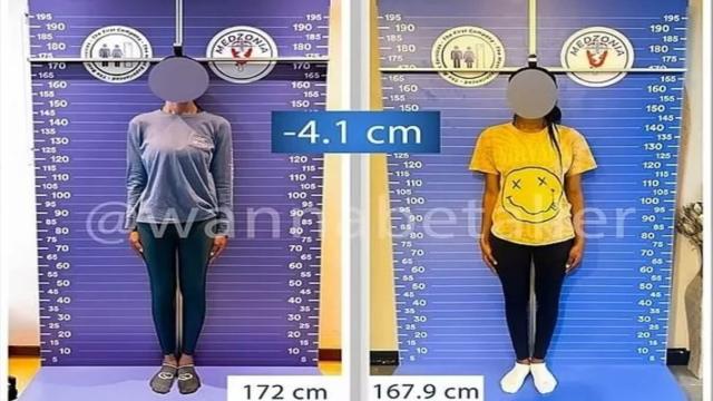 Почему девушки делают операции по укорачиванию ног — ужасный тренд в мире моды