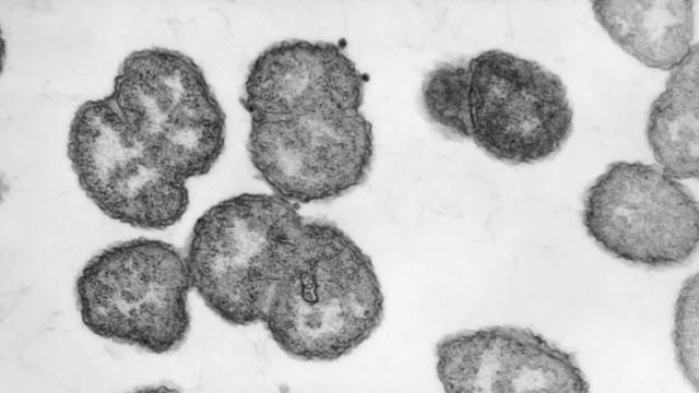 Что будет, если человек съест бактерии гонореи? Реальный случай из 1984 года