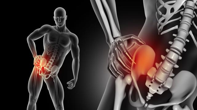 В Новосибирске запустят производство покрытий для протеза тазобедренного сустава