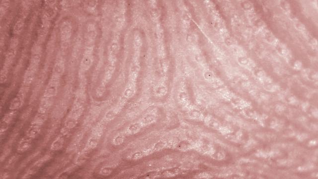 Почему пот воняет именно в подмышках?