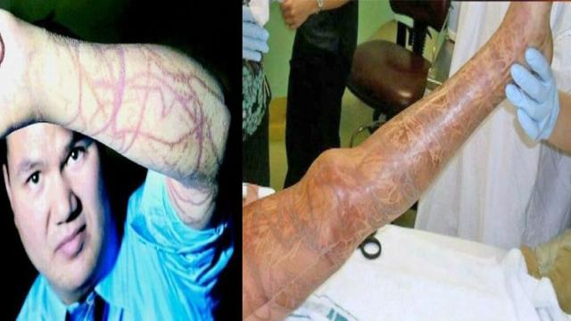 Чем опасны кубомедузы и где они водятся: инструкции для тех, кто едет в отпуск