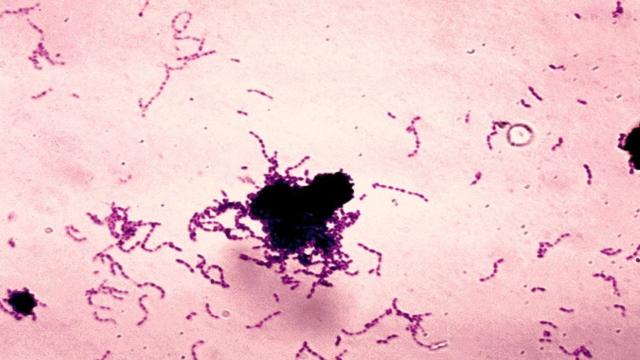 Как сладкое разрушает зубы и что с этим делать