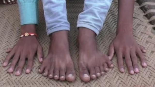 Почему у нас по 5 пальцев на руках и ногах?