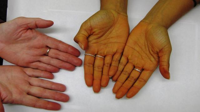 Как морковь помогает улучшить зрение? Известный миф наполовину верен