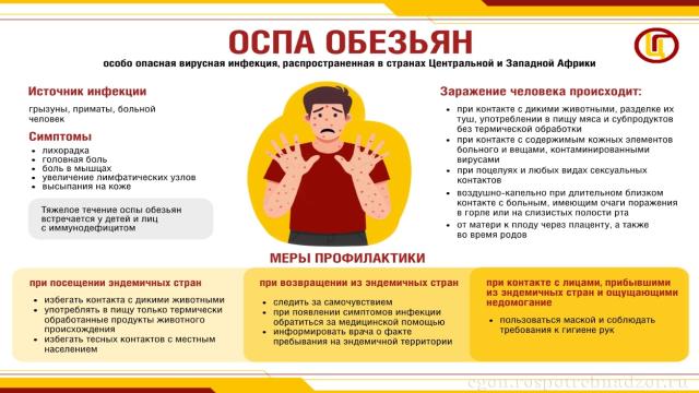 Оспа обезьян в России: стоит ли ее бояться на самом деле?