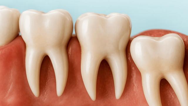 Почему раньше люди думали, что в зубах человека живут черви