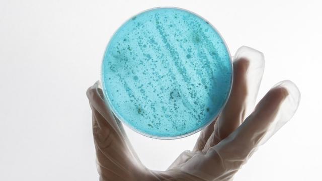 В России разработали «умный» анализ бактериальных биопленок