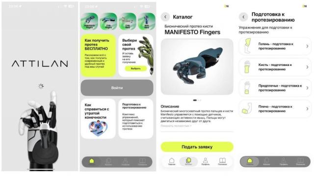 «Группа Моторика» представила первый российский модуль локтя для бионических протезов