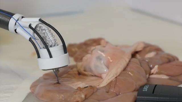 Новый 3D-биопринтер может восстанавливать ткани изнутри. Серьёзные операции не нужны