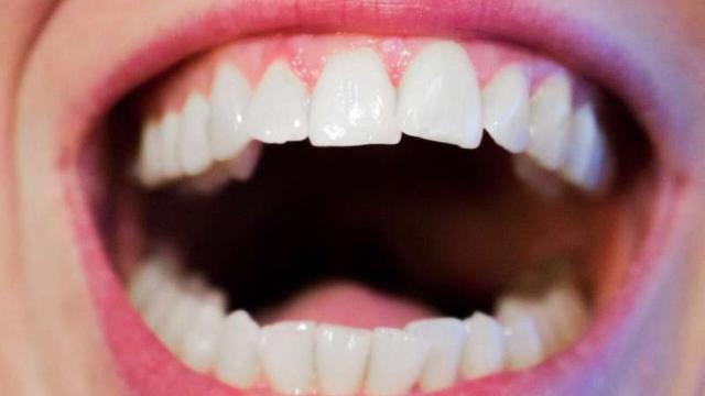 Как связаны диабет и заболевания полости рта: ответ ученых