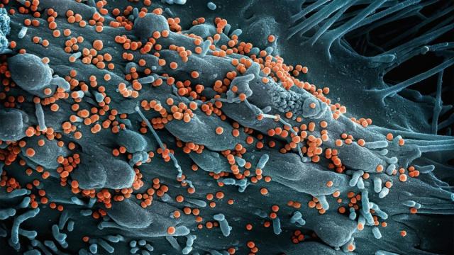 Ученые научили бактерии пожирать раковые опухоли изнутри