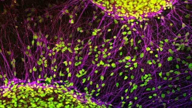 Новый метод обращения вспять клеточного старения протестируют на людях
