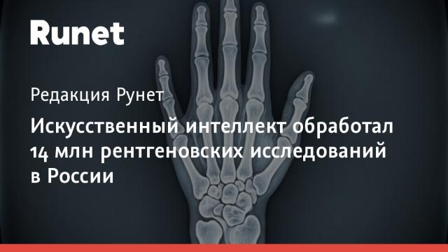 Искусственный интеллект обработал 14 млн рентгеновских исследований в России